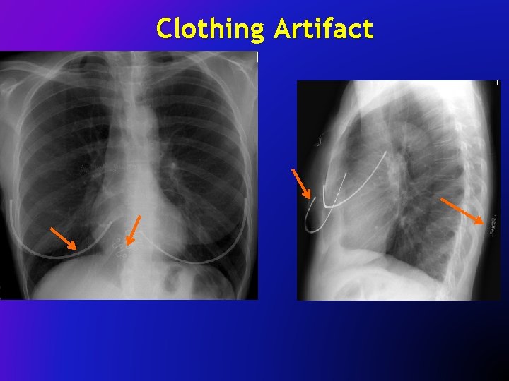 Clothing Artifact 