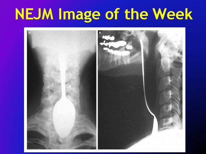 NEJM Image of the Week 
