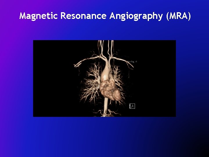 Magnetic Resonance Angiography (MRA) 