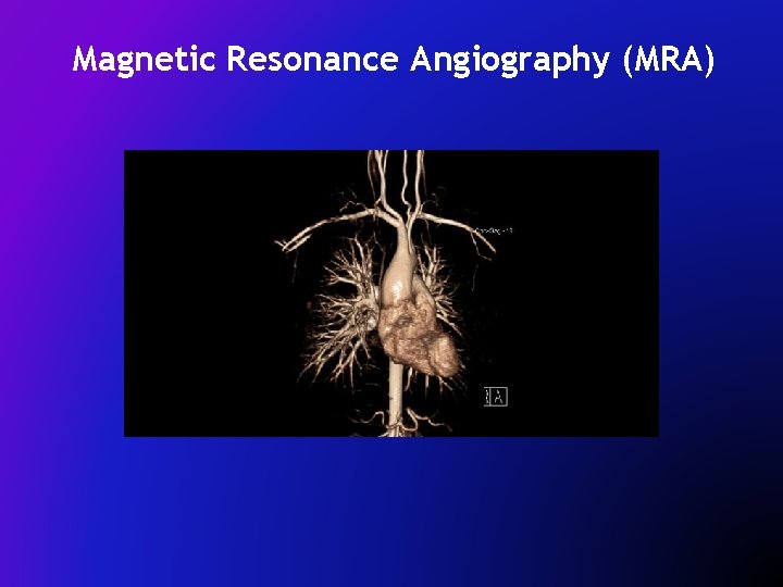 Magnetic Resonance Angiography (MRA) 