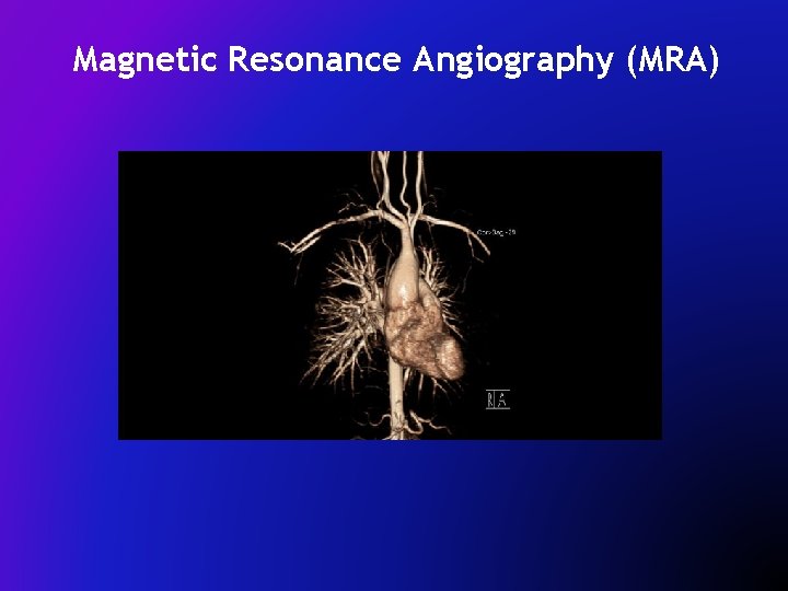 Magnetic Resonance Angiography (MRA) 