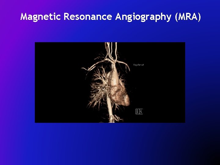Magnetic Resonance Angiography (MRA) 