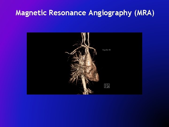 Magnetic Resonance Angiography (MRA) 