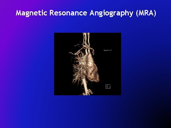 Magnetic Resonance Angiography (MRA) 