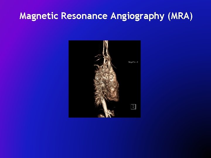 Magnetic Resonance Angiography (MRA) 