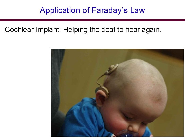 Application of Faraday’s Law Cochlear Implant: Helping the deaf to hear again. 