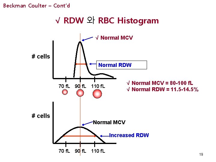 Beckman Coulter – Cont’d √ RDW 와 RBC Histogram √ Normal MCV # cells