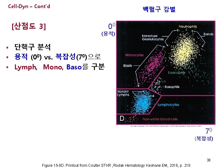 Cell-Dyn – Cont’d [산점도 3] 백혈구 감별 00 (용적) • 단핵구 분석 • 용적