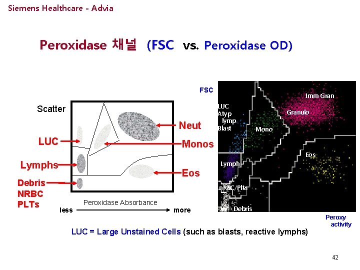 Siemens Healthcare - Advia Peroxidase 채널 (FSC vs. Peroxidase OD) FSC Scatter Neut LUC