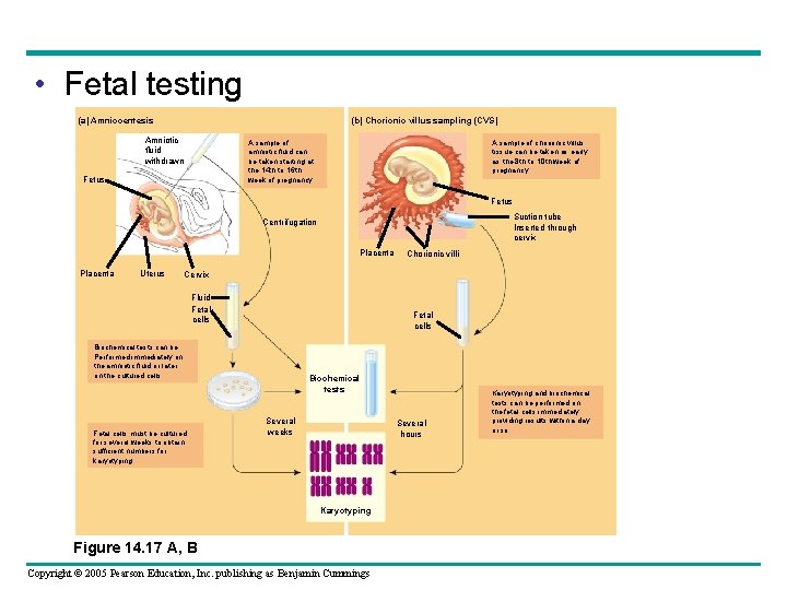  • Fetal testing (b) Chorionic villus sampling (CVS) (a) Amniocentesis Amniotic fluid withdrawn