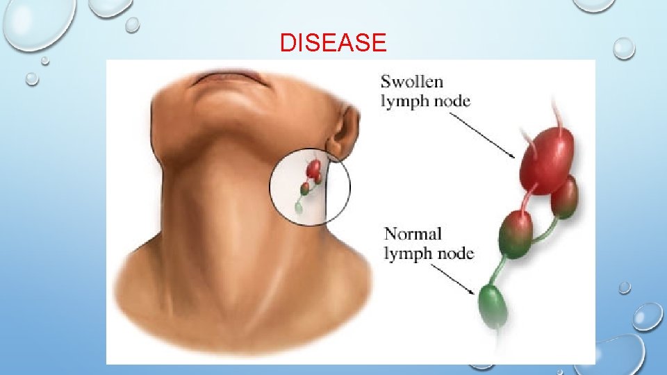 DISEASE 