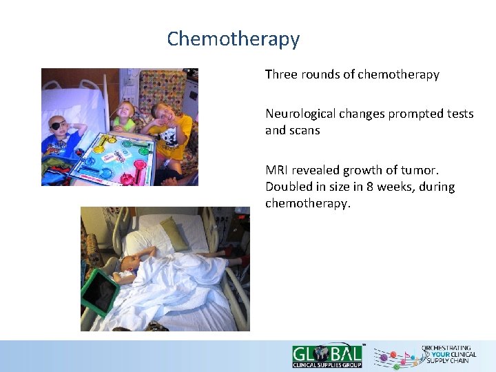 Chemotherapy Three rounds of chemotherapy Neurological changes prompted tests and scans MRI revealed growth