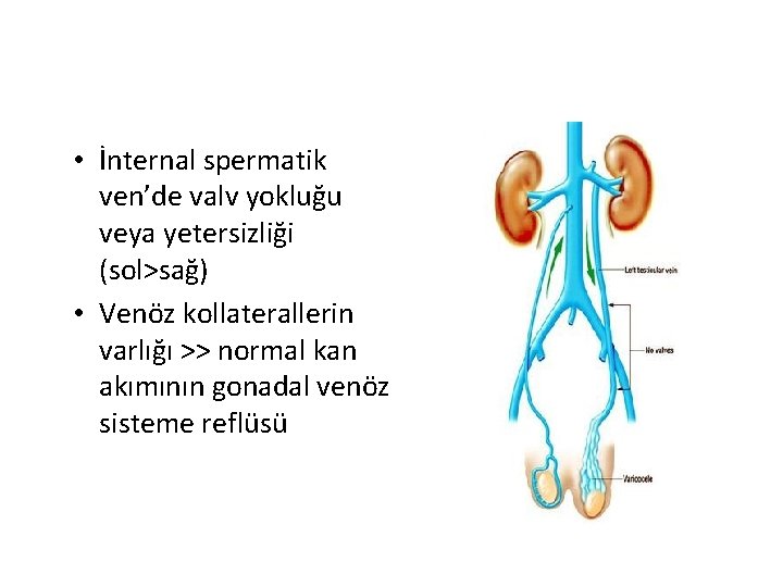  • İnternal spermatik ven’de valv yokluğu veya yetersizliği (sol>sağ) • Venöz kollaterallerin varlığı