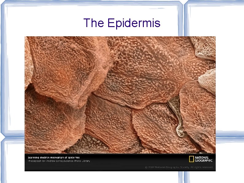 The Epidermis 