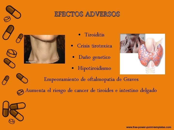 EFECTOS ADVERSOS • Tiroiditis • Crisis tirotoxica • Daño genetico • Hipotiroidismo Empeoramiento de