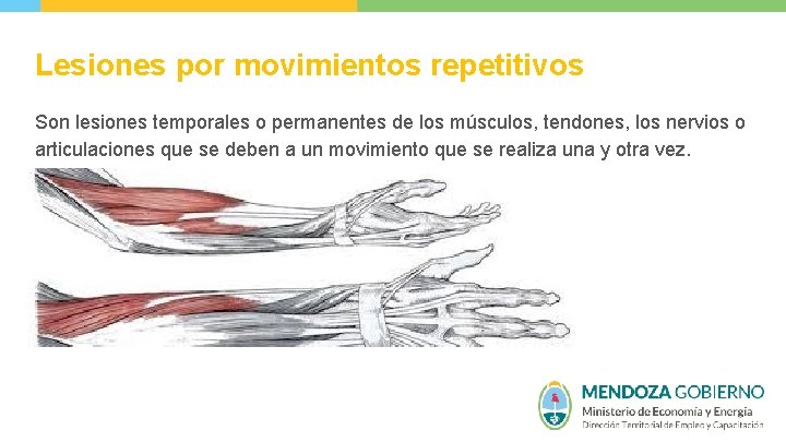 Lesiones por movimientos repetitivos Son lesiones temporales o permanentes de los músculos, tendones, los