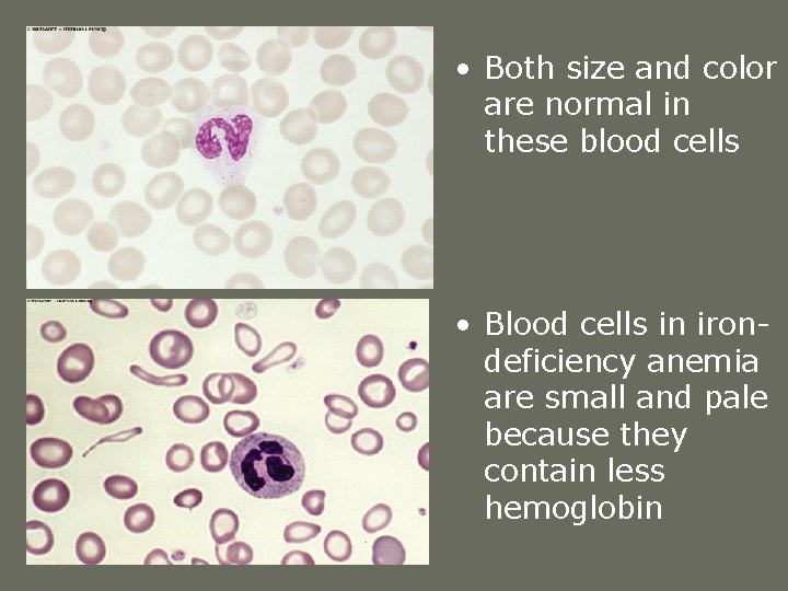 • Both size and color are normal in these blood cells • Blood • Both size and color are normal in these blood cells • Blood