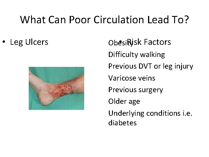 What Can Poor Circulation Lead To? • Leg Ulcers • Risk Factors Obesity Difficulty