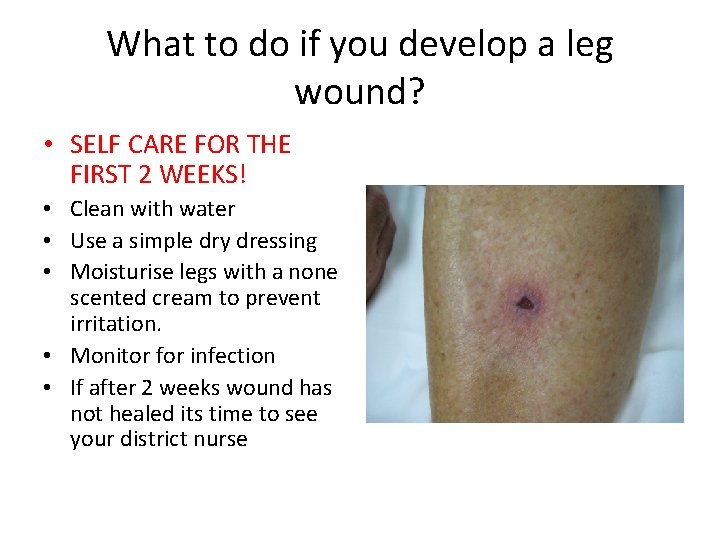 What to do if you develop a leg wound? • SELF CARE FOR THE