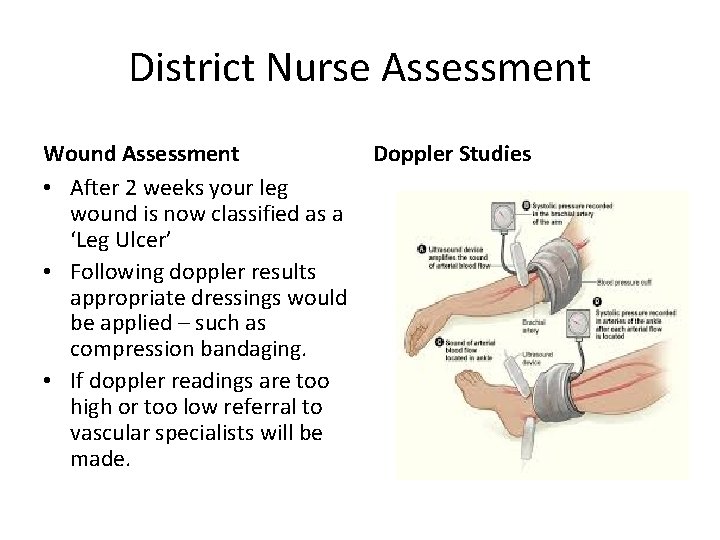 District Nurse Assessment Wound Assessment • After 2 weeks your leg wound is now