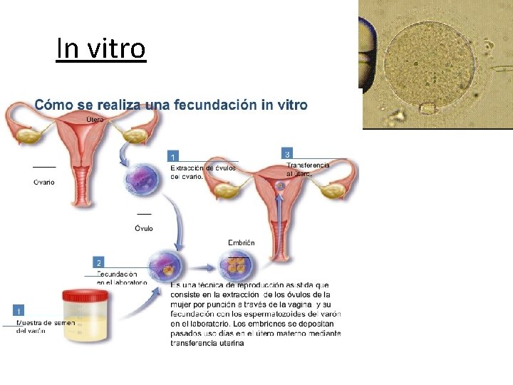 In vitro In vitro