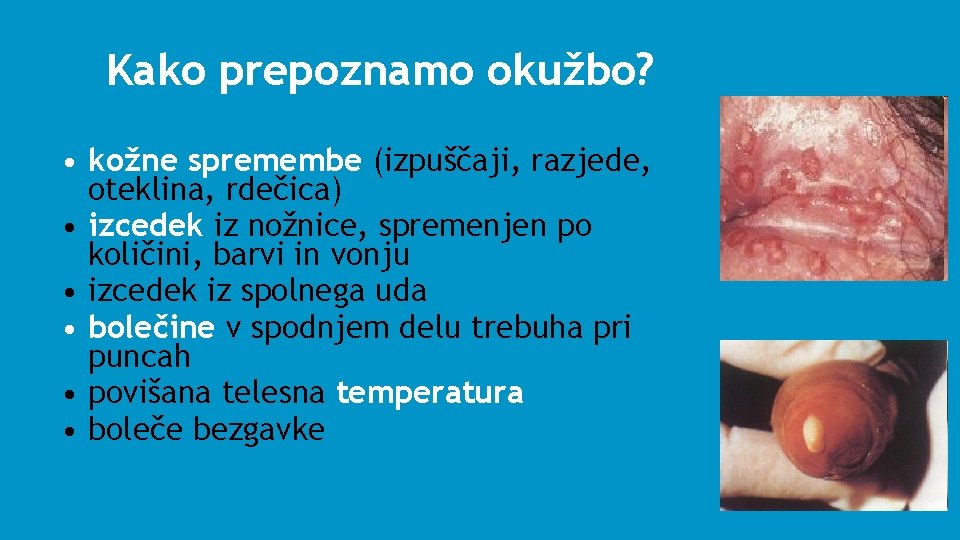 Kako prepoznamo okužbo? • kožne spremembe (izpuščaji, razjede, oteklina, rdečica) • izcedek iz nožnice,