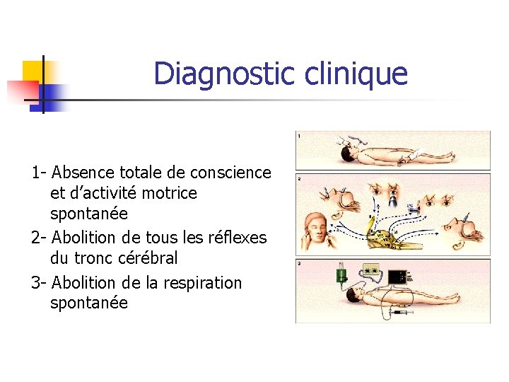 Diagnostic clinique 1 - Absence totale de conscience et d’activité motrice spontanée 2 - Diagnostic clinique 1 - Absence totale de conscience et d’activité motrice spontanée 2 -