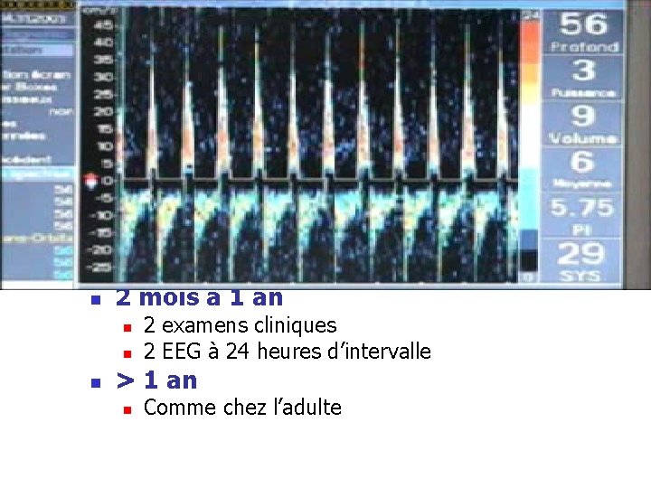 Particularité du diagnostic chez l’enfant n <7 j et prématuré n n 7 j Particularité du diagnostic chez l’enfant n <7 j et prématuré n n 7 j