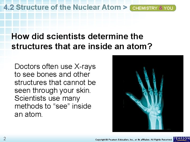 4. 2 Structure of the Nuclear Atom > CHEMISTRY & YOU How did scientists