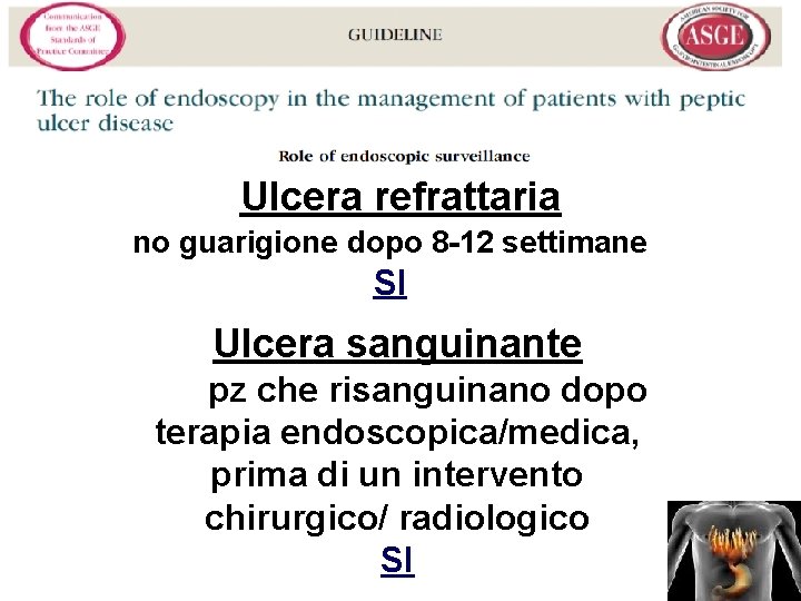 Ulcera refrattaria no guarigione dopo 8 -12 settimane SI Ulcera sanguinante nei pz che