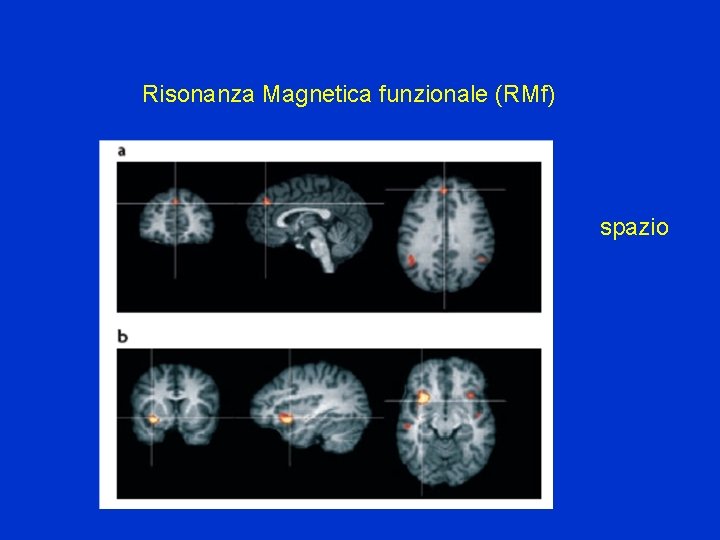 Risonanza Magnetica funzionale (RMf) spazio 