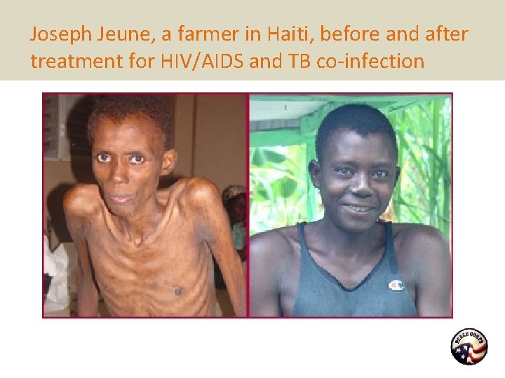 Joseph Jeune, a farmer in Haiti, before and after treatment for HIV/AIDS and TB
