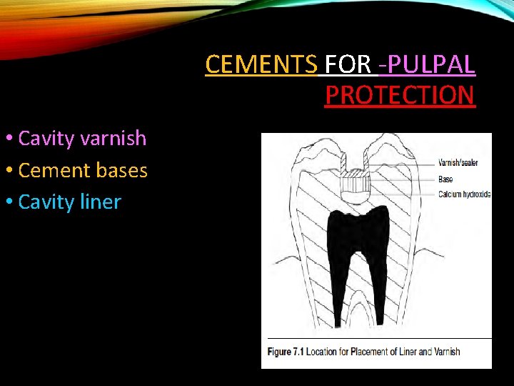 CEMENTS FOR -PULPAL PROTECTION • Cavity varnish • Cement bases • Cavity liner 