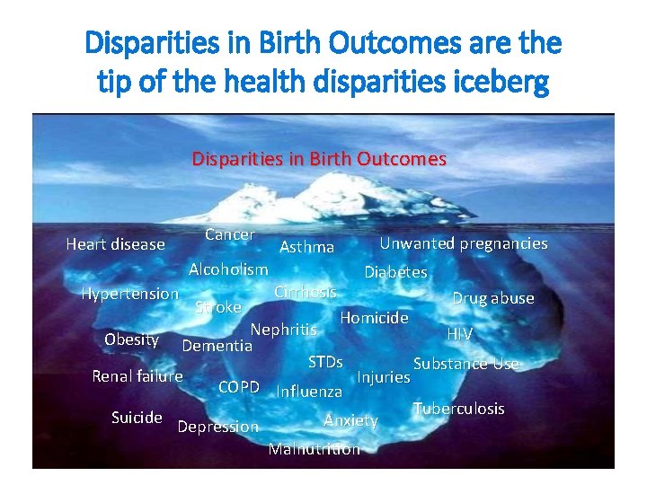 Disparities in Birth Outcomes are the tip of the health disparities iceberg Disparities in Disparities in Birth Outcomes are the tip of the health disparities iceberg Disparities in