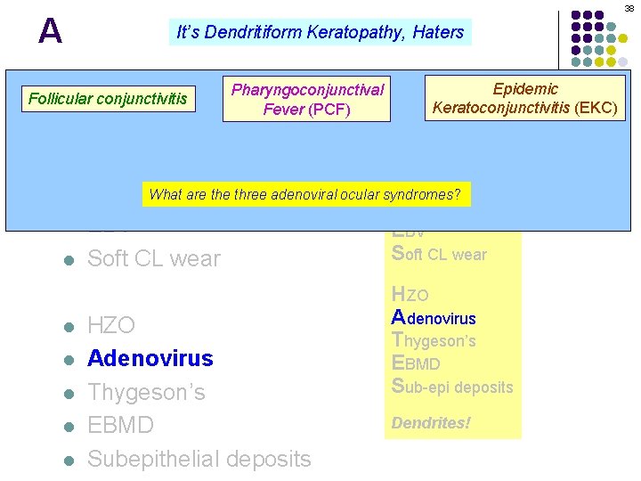 A 38 It’s Dendritiform Keratopathy, Haters Pharyngoconjunctival Dendritiform keratopathy: DDx l Follicular conjunctivitis l