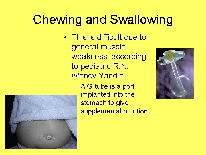 Chewing and Swallowing • This is difficult due to general muscle weakness, according to
