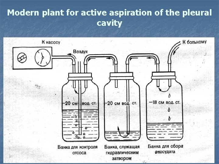 Modern plant for active aspiration of the pleural cavity 