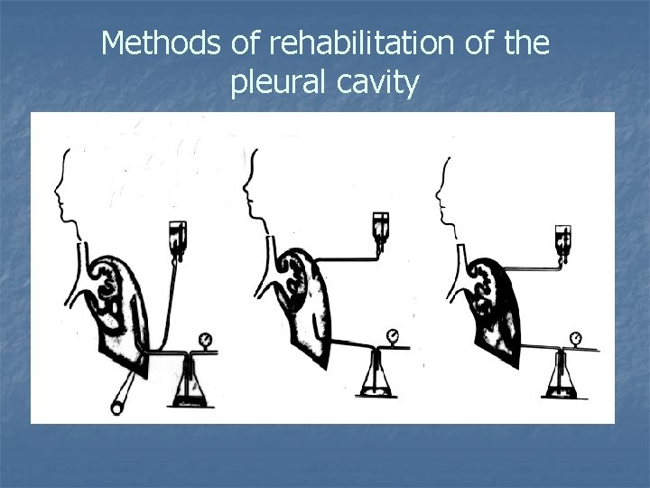 Methods of rehabilitation of the pleural cavity 