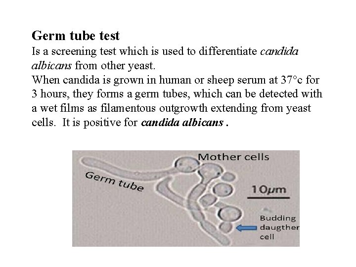 Germ tube test Is a screening test which is used to differentiate candida albicans