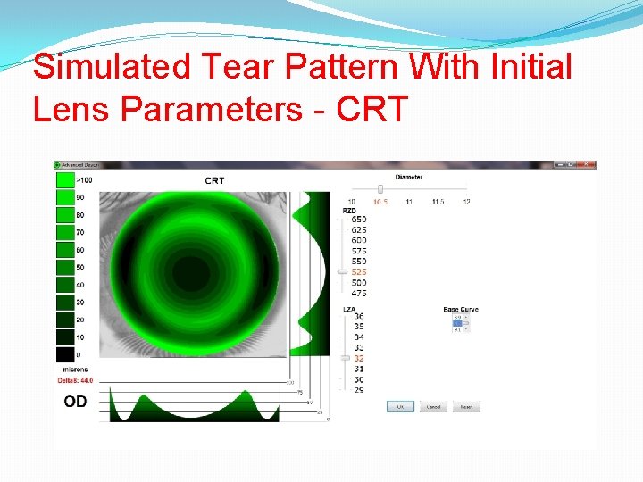 Simulated Tear Pattern With Initial Lens Parameters - CRT 