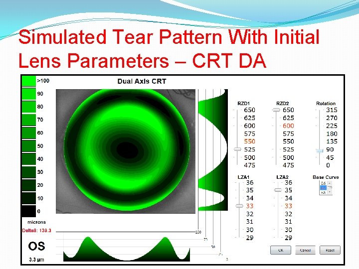 Simulated Tear Pattern With Initial Lens Parameters – CRT DA 