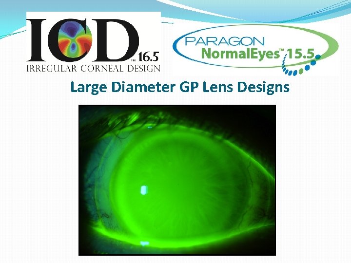 Large Diameter GP Lens Designs 