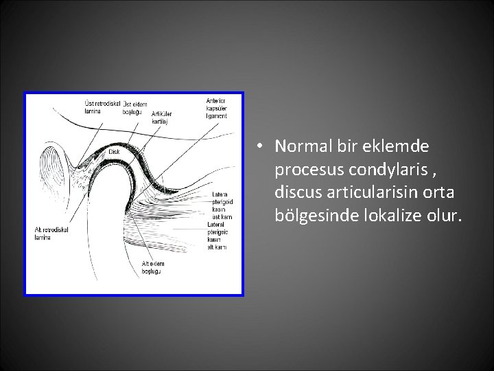  • Normal bir eklemde procesus condylaris , discus articularisin orta bölgesinde lokalize olur.