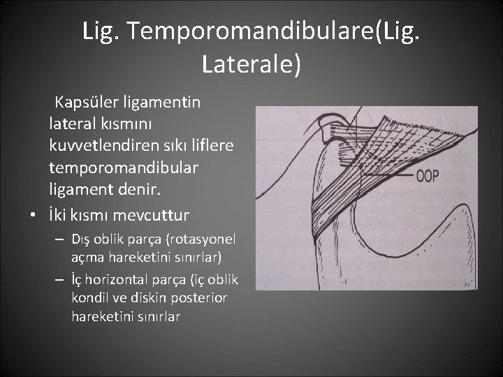 Lig. Temporomandibulare(Lig. Laterale) Kapsüler ligamentin lateral kısmını kuvvetlendiren sıkı liflere temporomandibular ligament denir. •