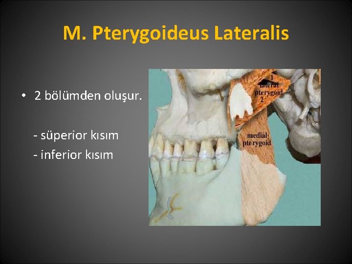 M. Pterygoideus Lateralis • 2 bölümden oluşur. - süperior kısım - inferior kısım 