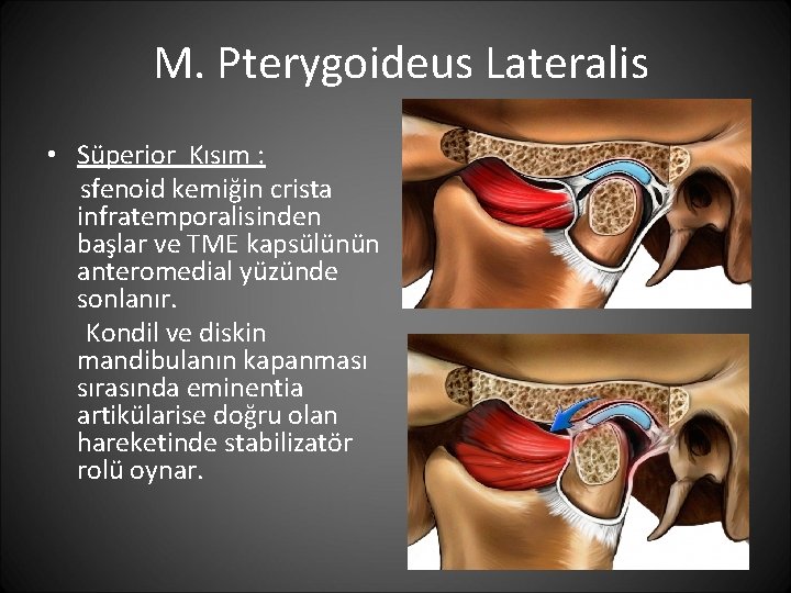M. Pterygoideus Lateralis • Süperior Kısım : sfenoid kemiğin crista infratemporalisinden başlar ve TME