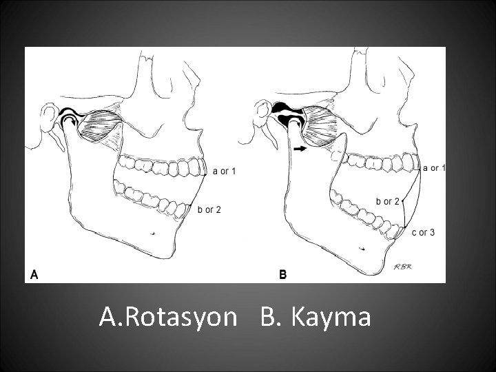 A. Rotasyon B. Kayma 