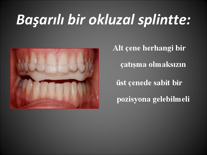 Başarılı bir okluzal splintte: Alt çene herhangi bir çatışma olmaksızın üst çenede sabit bir