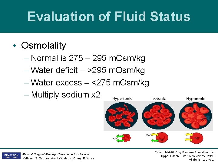 Evaluation of Fluid Status • Osmolality – Normal is 275 – 295 m. Osm/kg Evaluation of Fluid Status • Osmolality – Normal is 275 – 295 m. Osm/kg