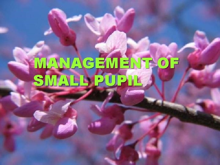 MANAGEMENT OF SMALL PUPIL 